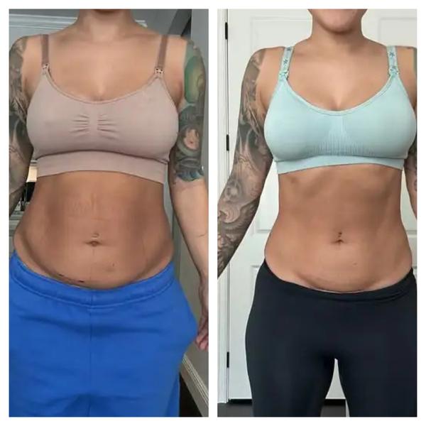 Lustra™ | Tighten Loose Skin & Flatten Your Tummy — Without Surgery